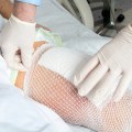 Adaptic Dressing Benefits You Didn’t Know About